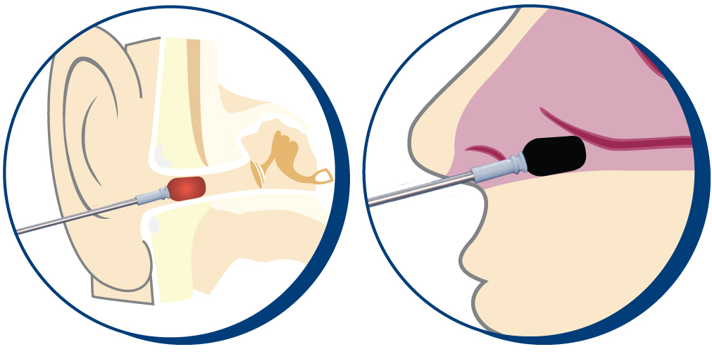 Illustrations_VacuTip.jpg